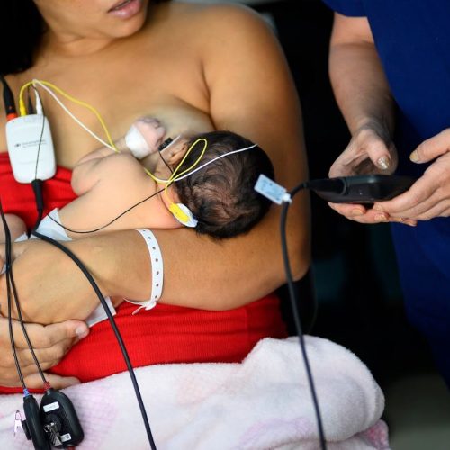 Hospital Regional do Gama passa a realizar exame para avaliação auditiva de recém-nascidos