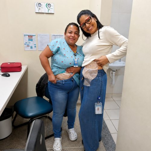 Profissionais do HRSM vivenciam rotina de pacientes com bolsa de estomia para fortalecer atendimento humanizado